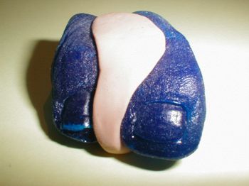 Zwischenzehenorthese